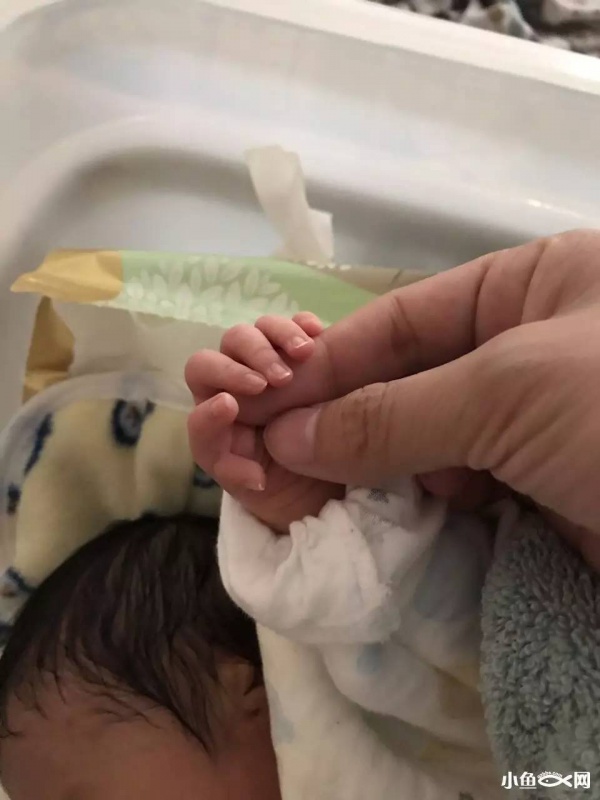 福建一产妇孕期产检全正常，婴儿生下来后却发现有6种畸形！关于产检，这些你必须知道！