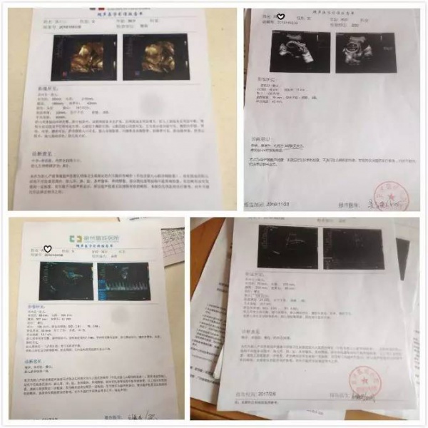 福建一产妇孕期产检全正常，婴儿生下来后却发现有6种畸形！关于产检，这些你必须知道！