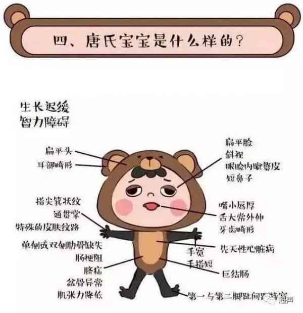 福建一产妇孕期产检全正常，婴儿生下来后却发现有6种畸形！关于产检，这些你必须知道！
