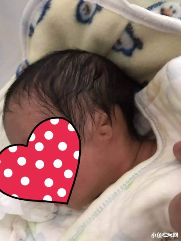 福建一产妇孕期产检全正常，婴儿生下来后却发现有6种畸形！关于产检，这些你必须知道！