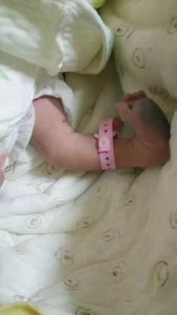 福建一产妇孕期产检全正常，婴儿生下来后却发现有6种畸形！关于产检，这些你必须知道！